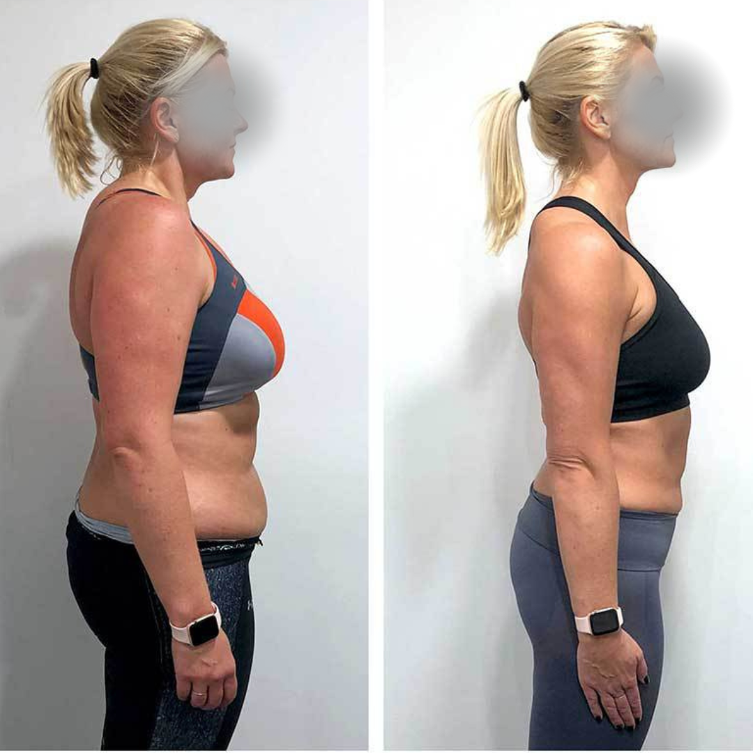 Antes e depois de aluna após o protocolo ancestral